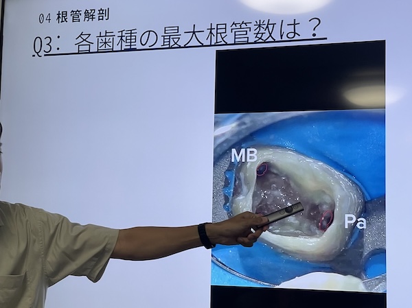 上村怜央先生による「歯内療法成功へのガイドセミナー」を受講いたしました