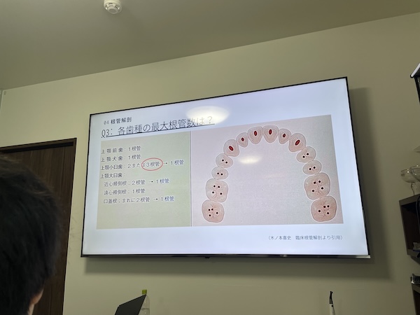上村怜央先生による「歯内療法成功へのガイドセミナー」を受講いたしました